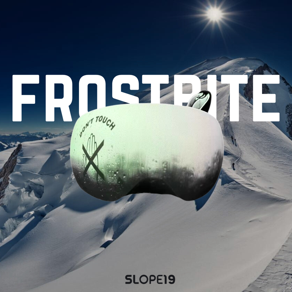 Frostbite